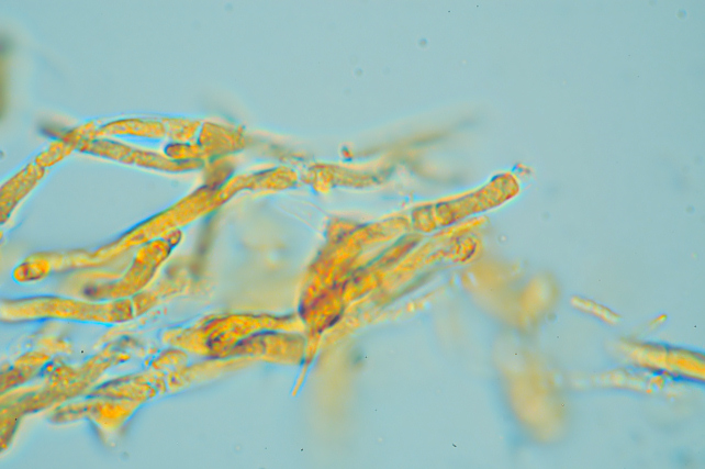 Una rara polyporacea: Parmastomyces mollissimus
